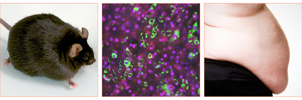 Enlarged view: Panels from left to right: obese mouse model, fluorescent imaging of fat cell development, obese human patient